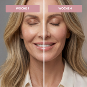 HierroBoost+ | Suero de crecimiento para pestañas