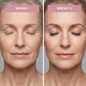 HierroBoost+ | Suero de crecimiento para pestañas