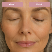 IronBoost+ | Groeiserum voor wimpers