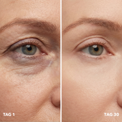 BrightAge | Anti-Rimpel Oogcrème