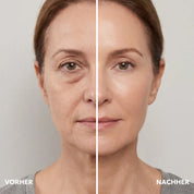 EyePeace | Under-eye patches – 60 pieces